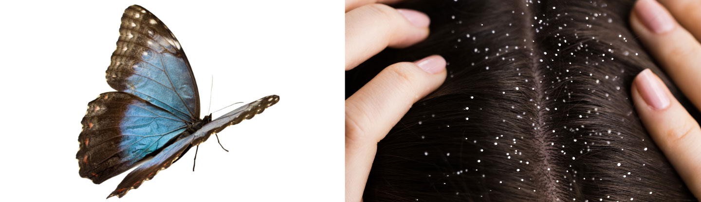 A comparison of hair with dandruff and without